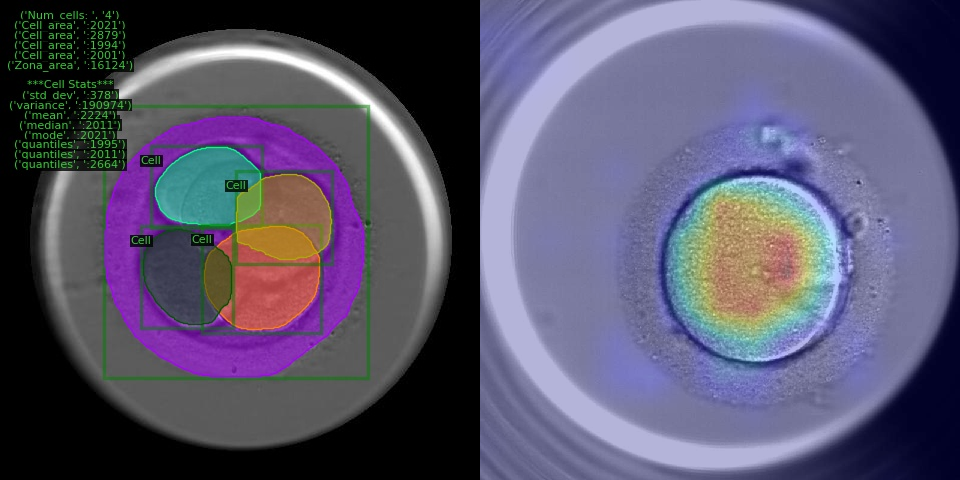 IVF-AI Visual